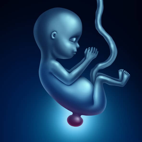 spinida bifida - animatie van baby in baarmoeder met open ruggetje