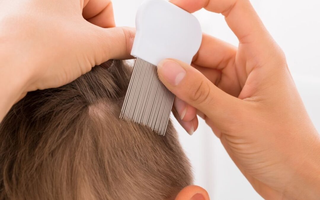 Hoe controleer ik mijn kind op hoofdluis?