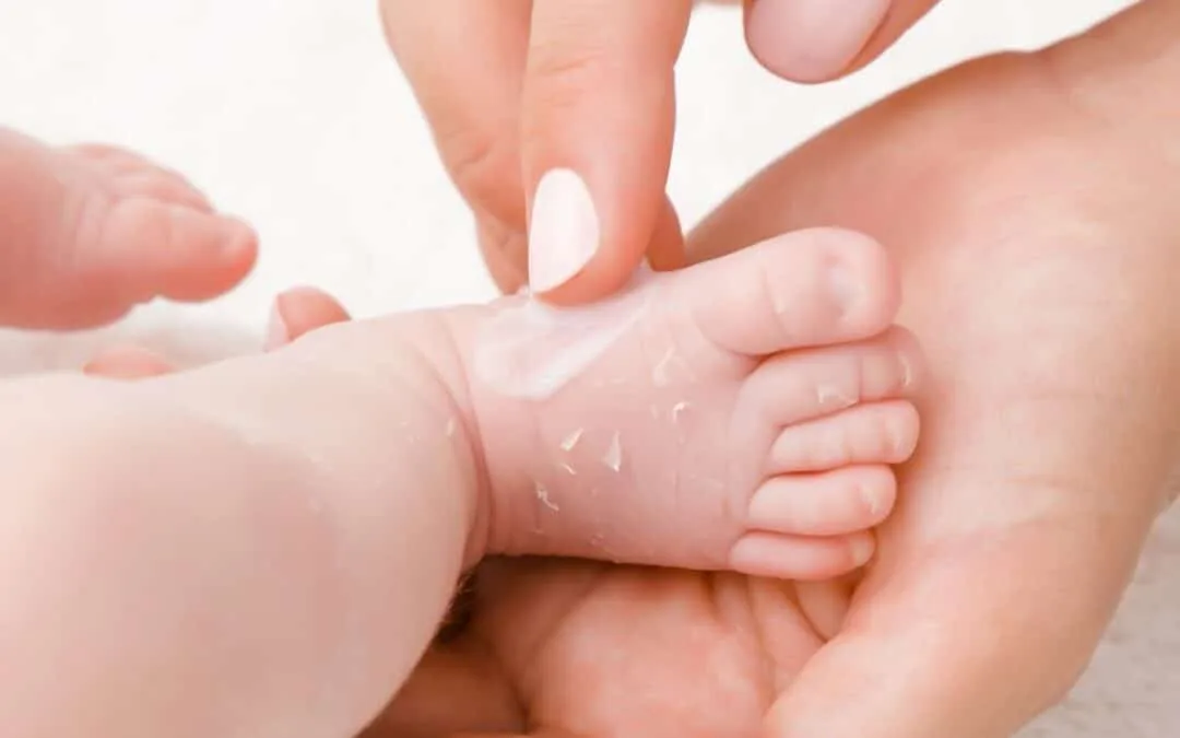 Hoe verzorg je de droge huid van je baby?