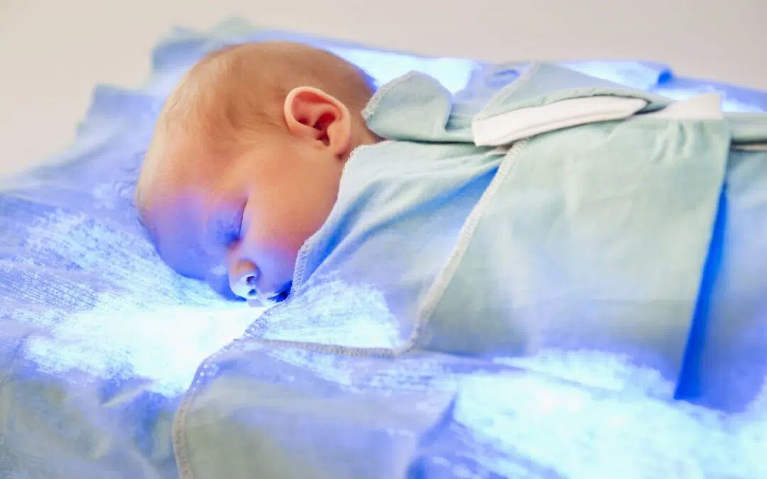 Geel zien bij baby’s