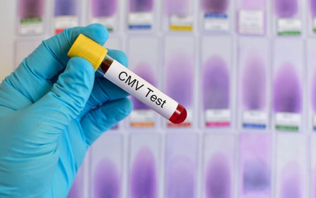 Cytomegalovirus (CMV): Wat is het en waar moet je op letten?