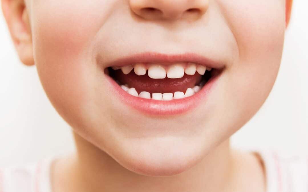 Dentinox verlicht pijn bij doorkomende tandjes.