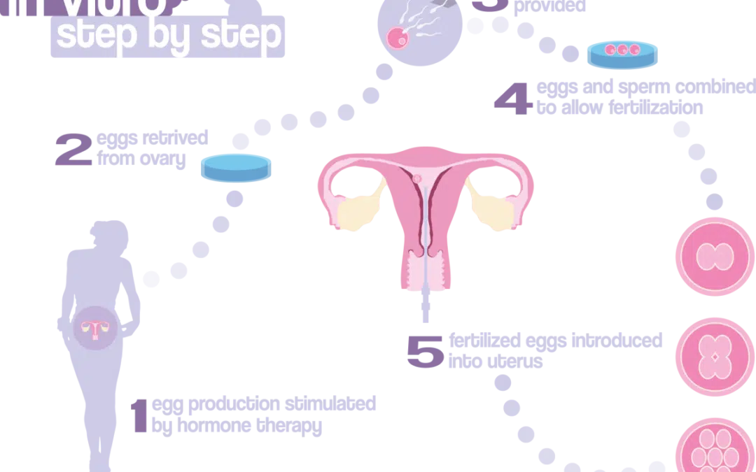 IVF vruchtbaarheidsbehandeling