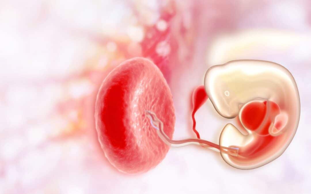 Placenta praevia: Wat is het en hoe wordt het behandeld?
