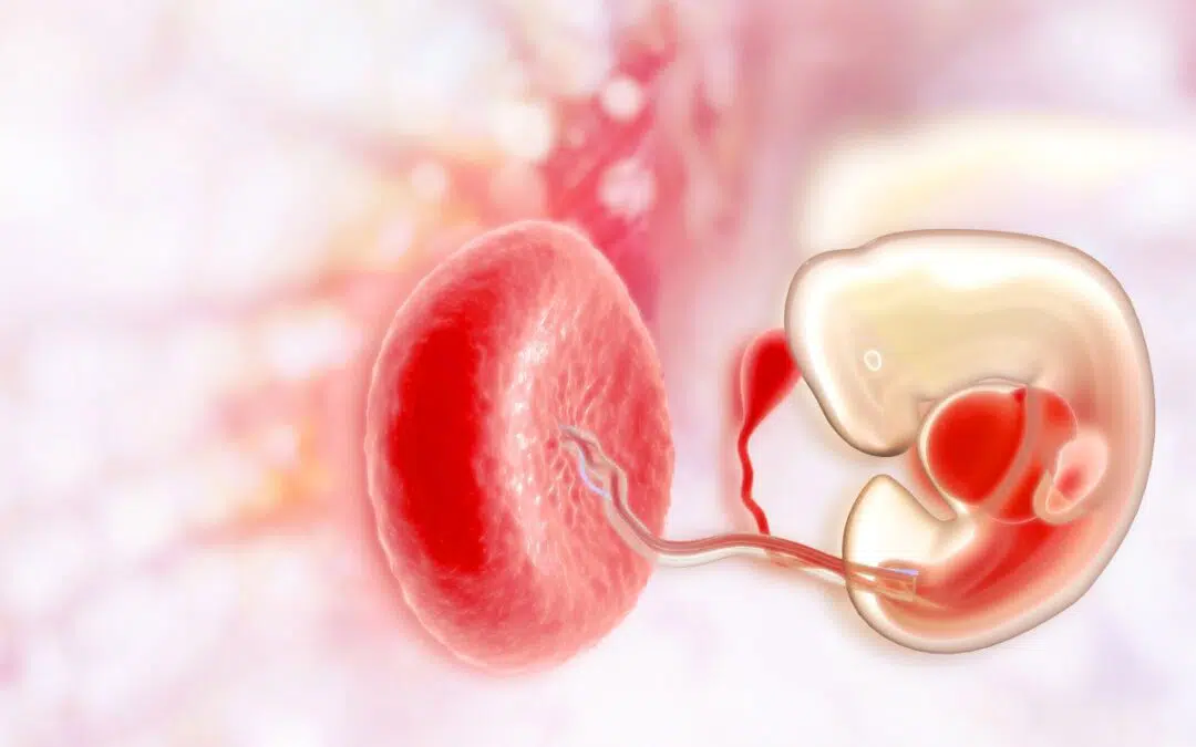 Placenta praevia: Wat is het en hoe wordt het behandeld?