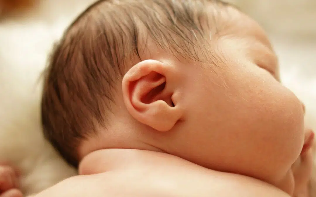 Waterhoofd bij je baby